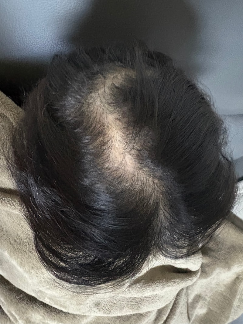요거.jpg