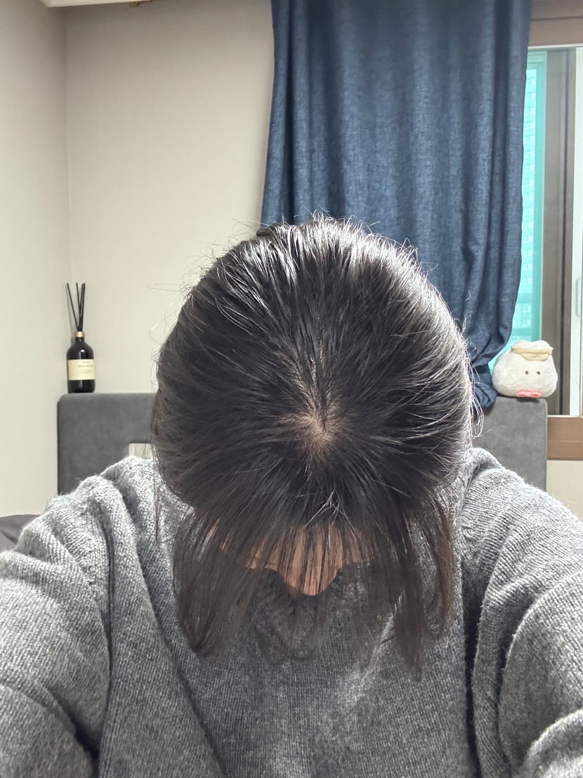 후
