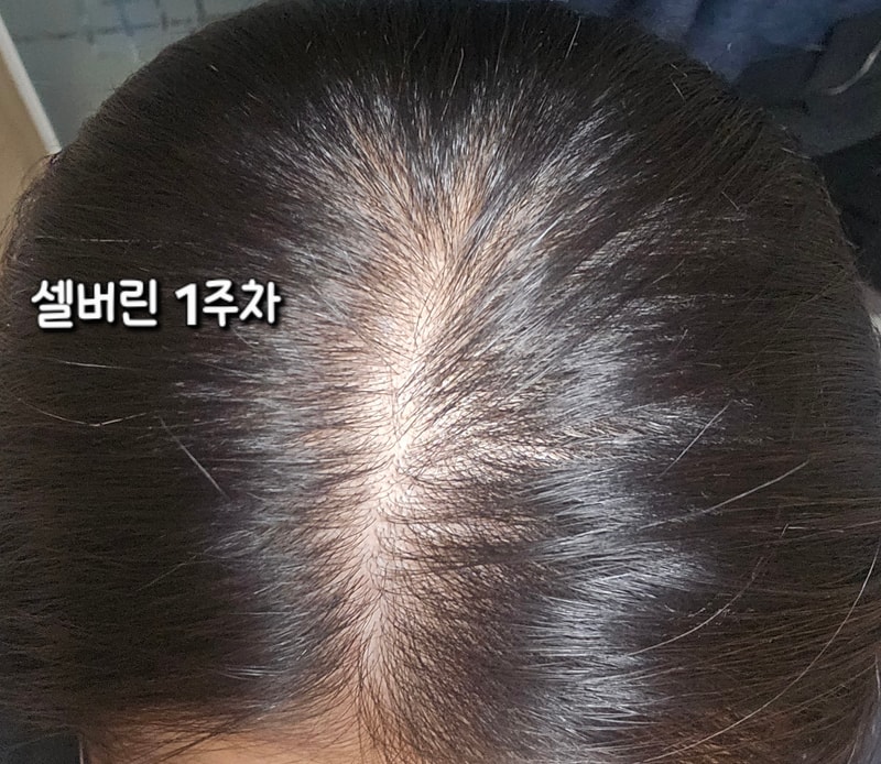 셀버린 1주차 사용후기