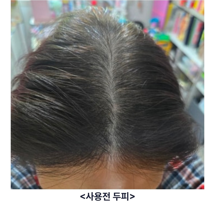 시작 1주차