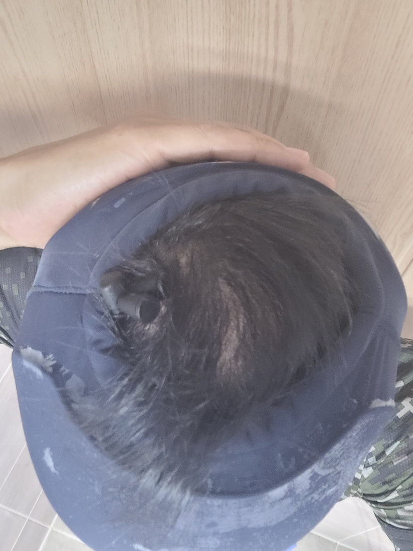 열린 뚜껑 ^_^ (정상인다)