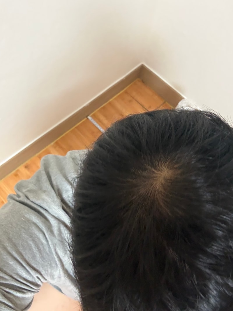 라보에이치 헤어라인 앰플 4주차 후기