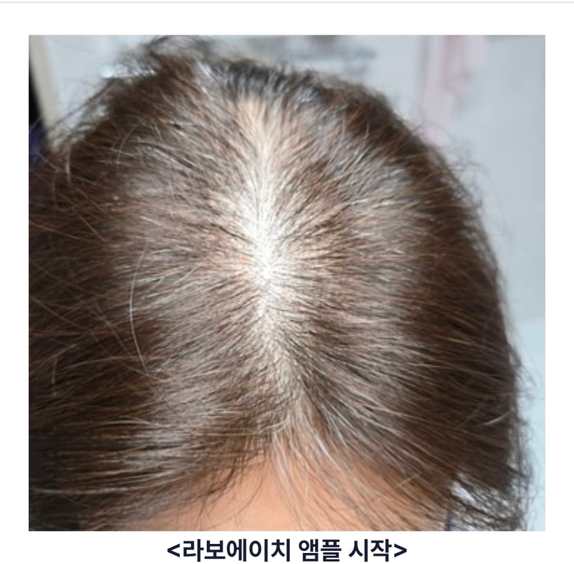 시작한날
