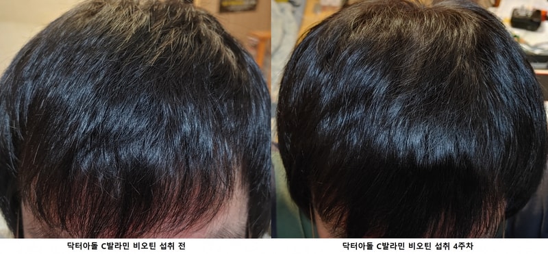 두정부 비교사진.png