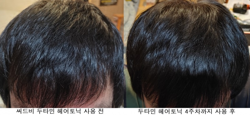 두정부 비교사진1.png