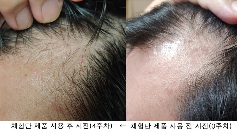 전후 사진.png