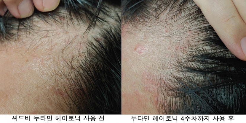 좌측라인 사용 전/후 사진