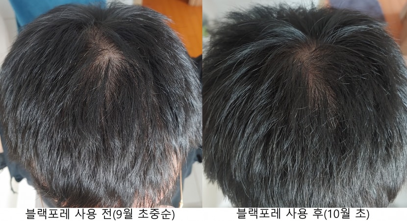 두정부 위쪽 비교사진