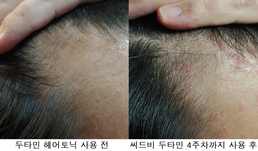 우측라인 사용 전/후 사진