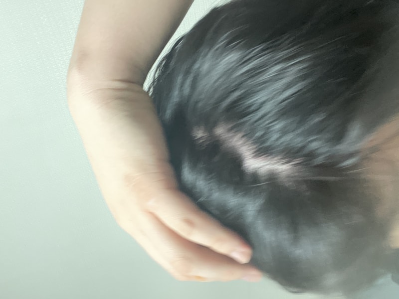 image.jpg