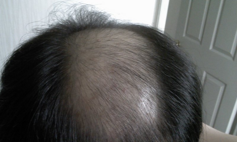2011-10-10 20.15.55.jpg