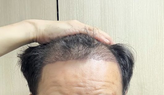 사진1.png