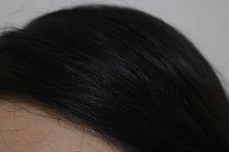 Vinic Regenoxil高级脱发洗发水 2周后记
