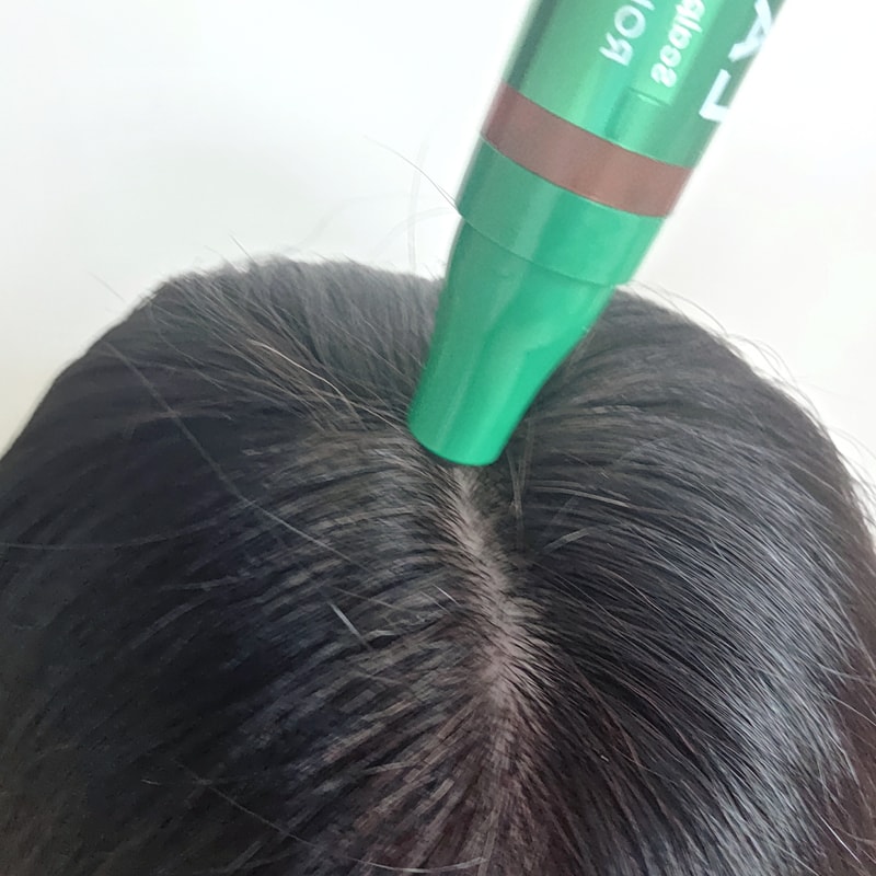 发际线安瓶第4周