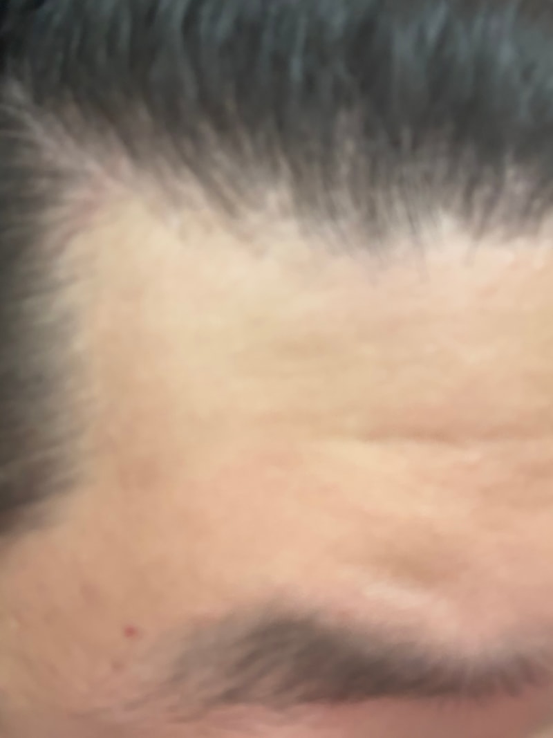 拜尼克两周后记