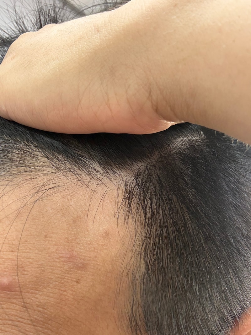 是洗发水2周后记。