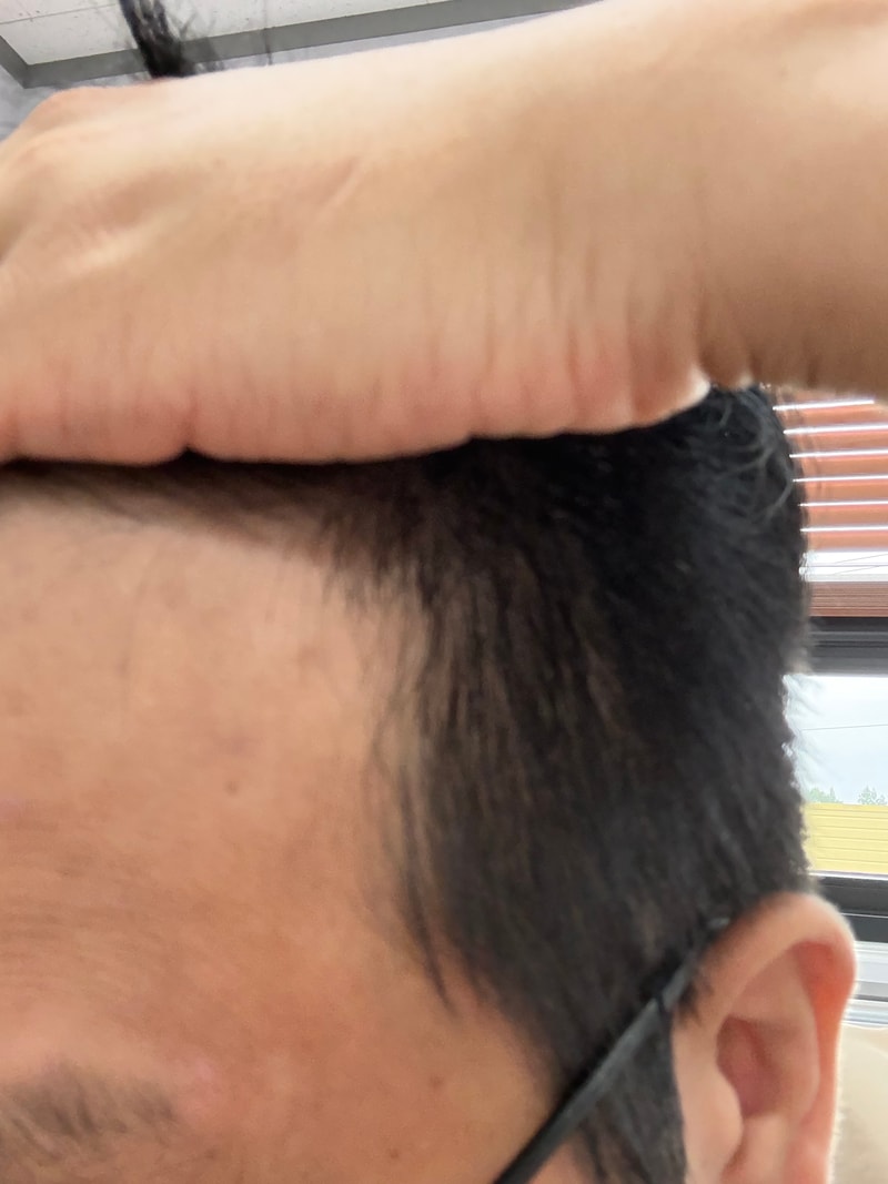 是洗发水第3周后期。
