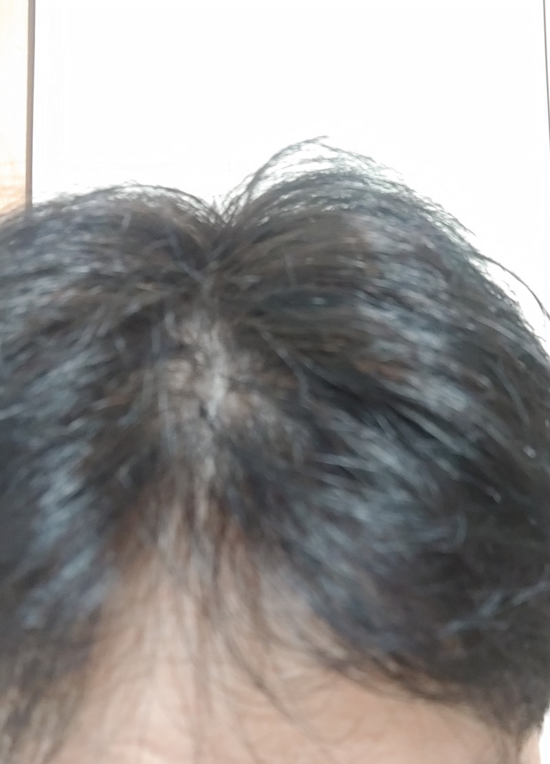 洗发水第3周后期