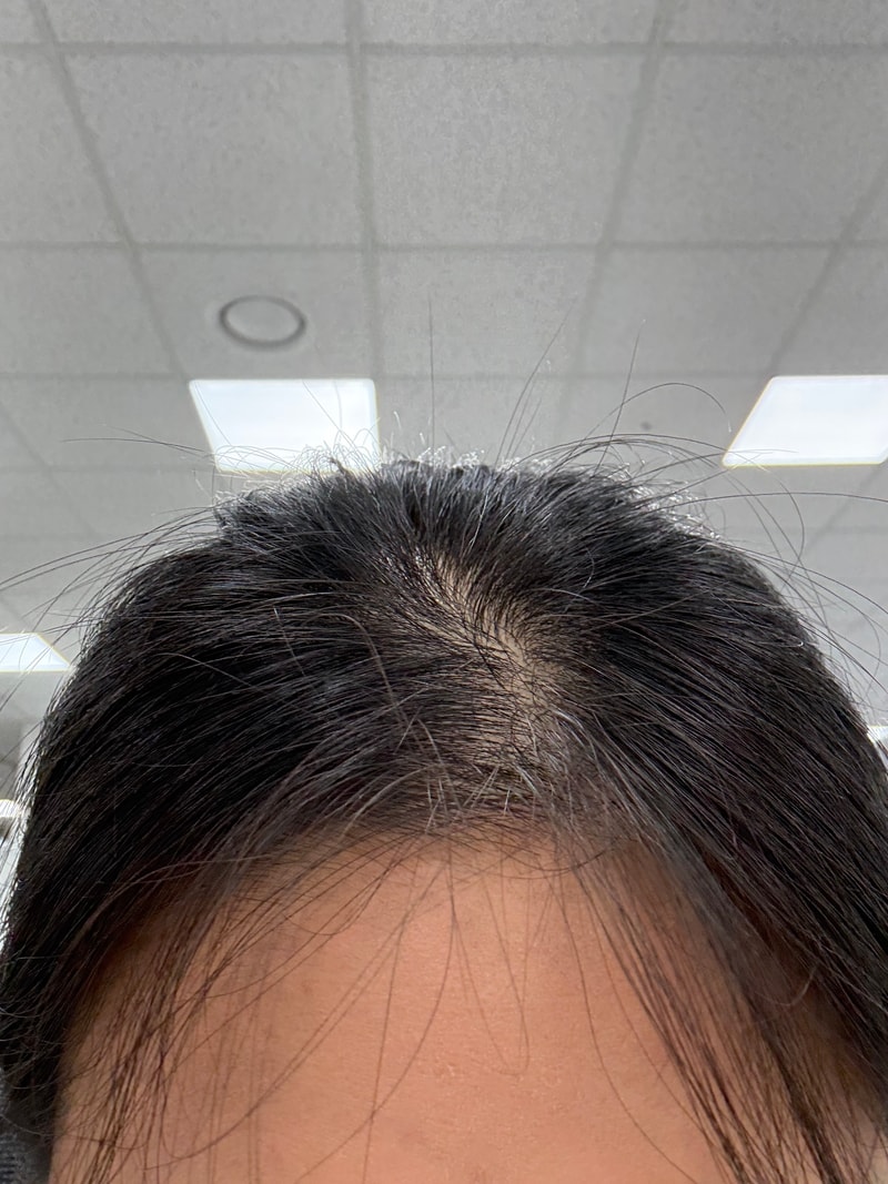 리제녹실 샴푸 4주차 후기