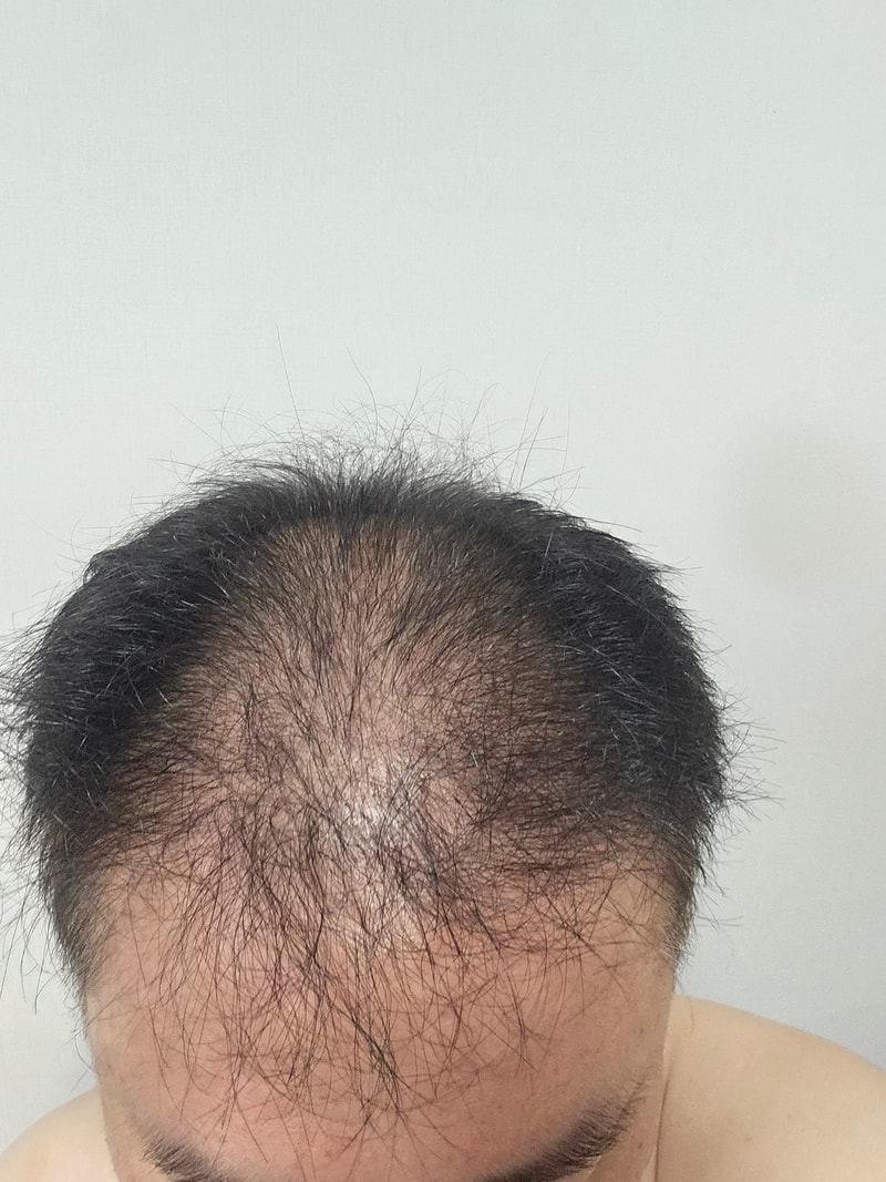 닥터노비드  2주차 사용기입니다