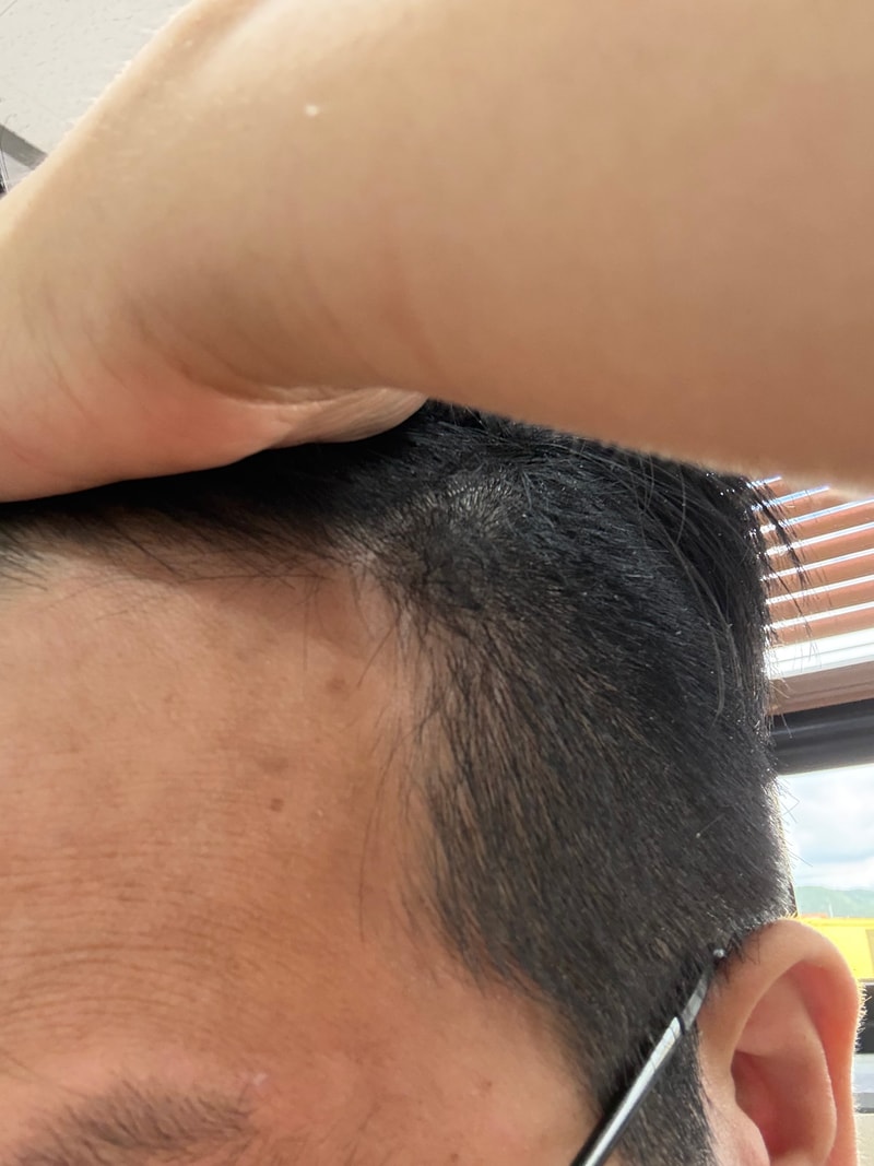 세레미 샴푸 3주차 후기 입니다.
