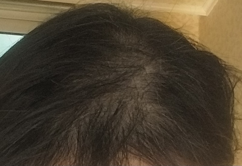 로블루 1주차 후기입니다.