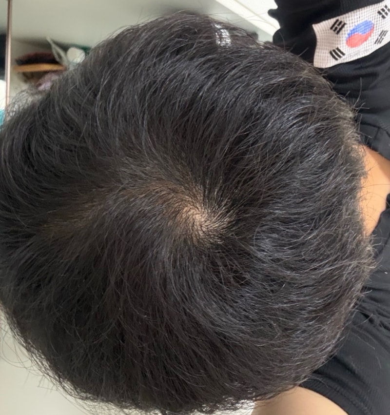 판토모나 비오틴 하이퍼포머 2주차입니다