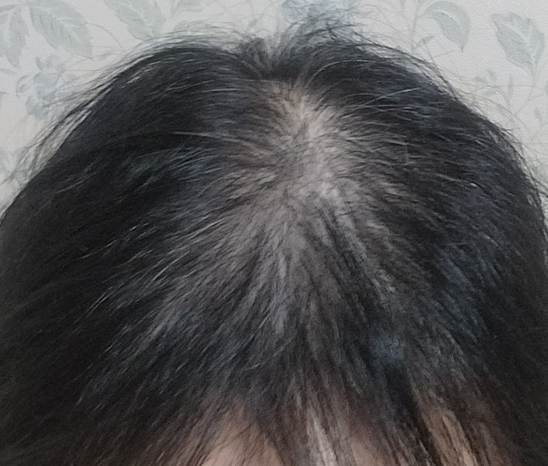 판토모나 비오틴 하이퍼포머 4주차 후기입니다.