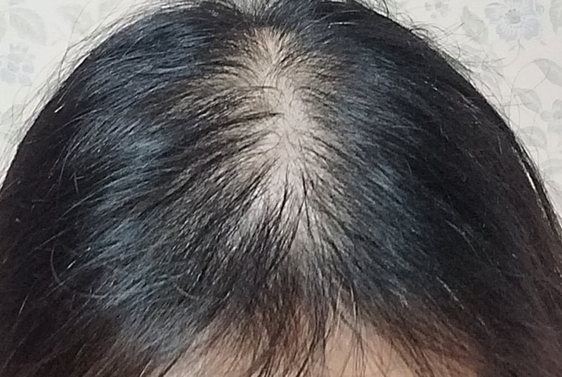 1000157757.jpg