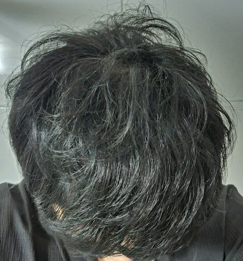 1000065778.jpg