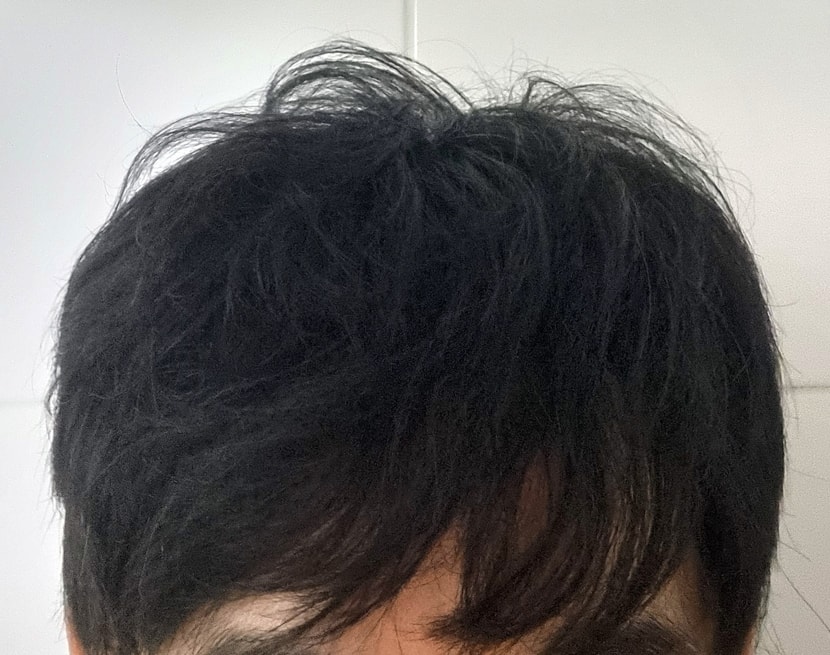 현재 모발상태