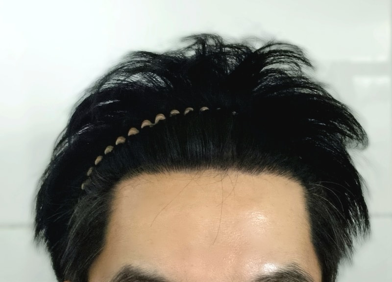 1000093709.jpg