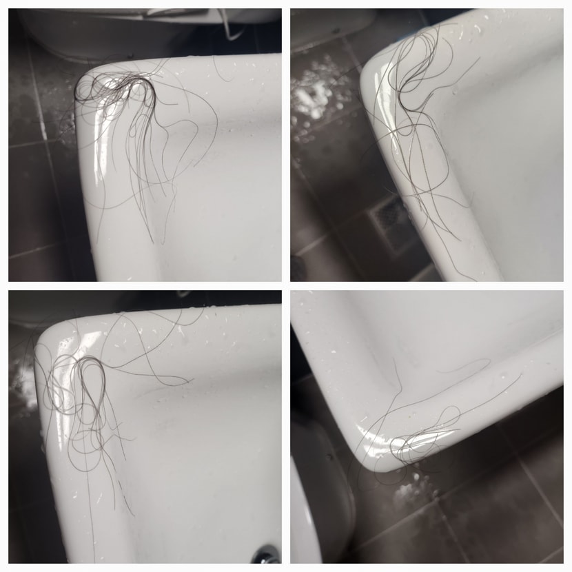 머리빠짐