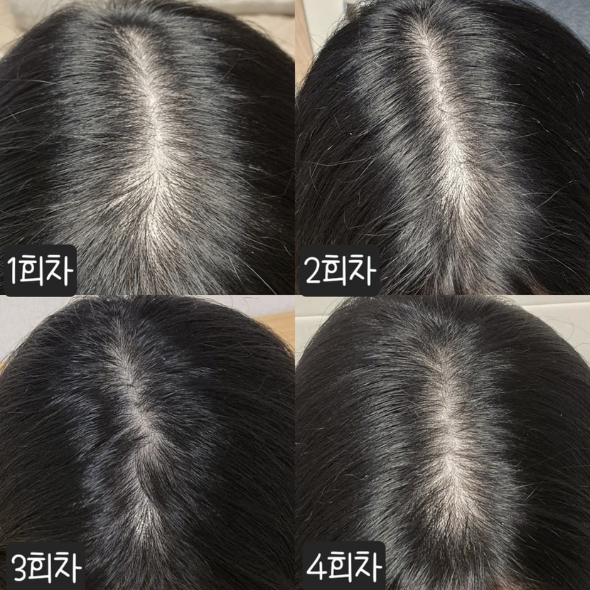 지금까지의 가르마 기록