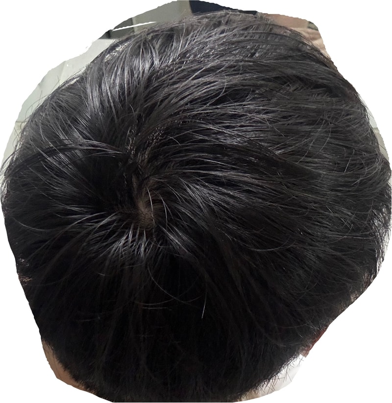 후.jpg