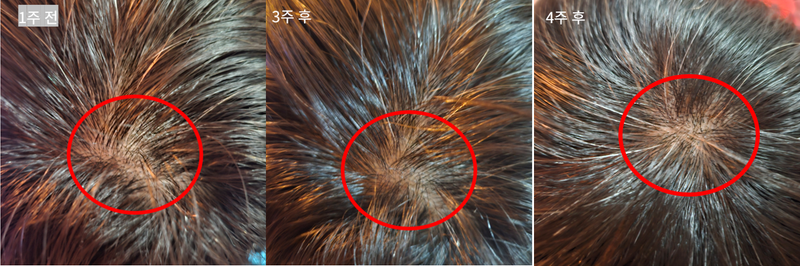 0. 마지막 전후비교.png