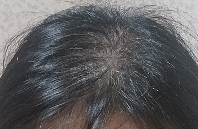 1000087176.jpg