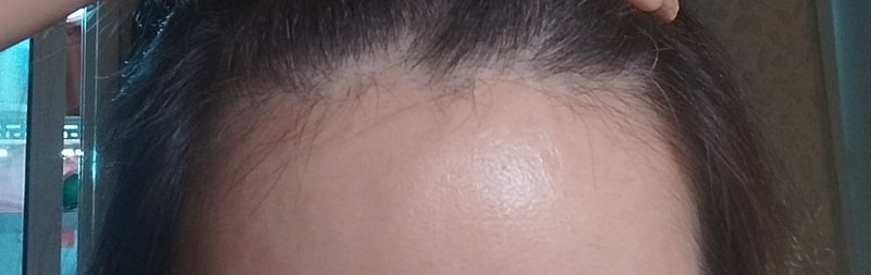 1000062227.jpg
