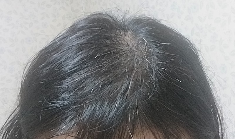 1000093763.jpg