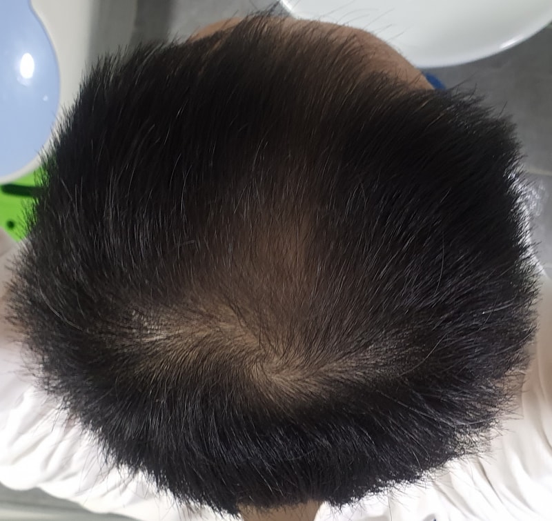 사용후.jpg