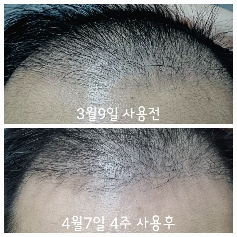 클라디에 사용후기.jpg
