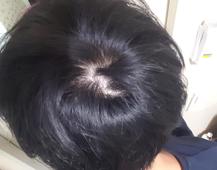 체험단3주.png
