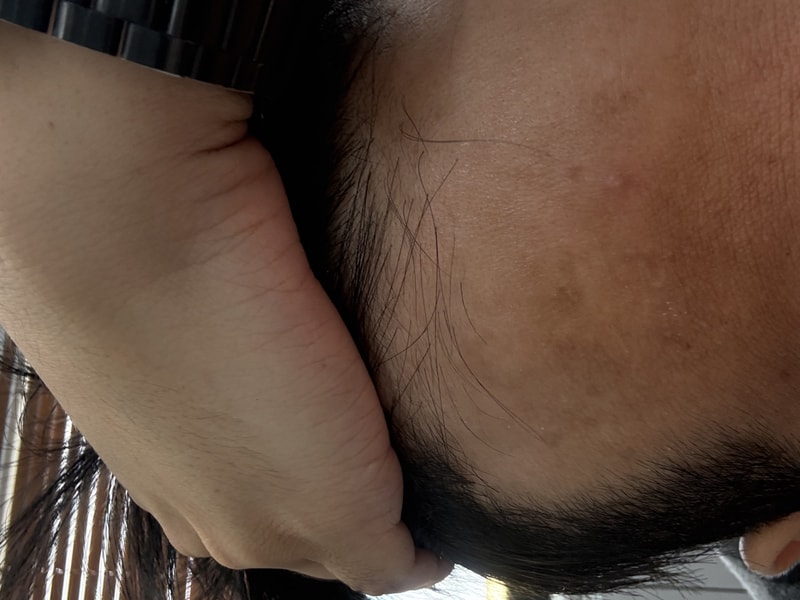 이다훈병신.jpg