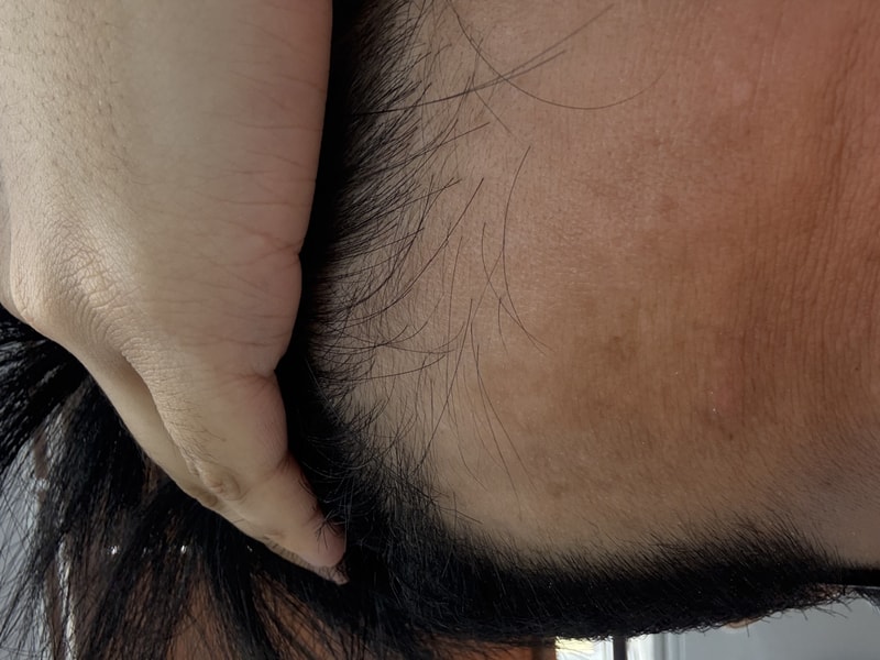 다훈리병신.jpg