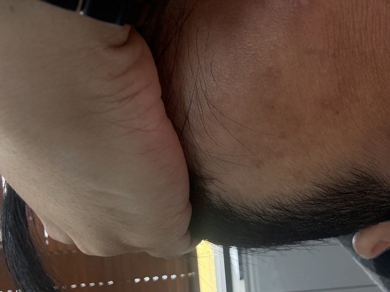 팻훈다병신.jpg