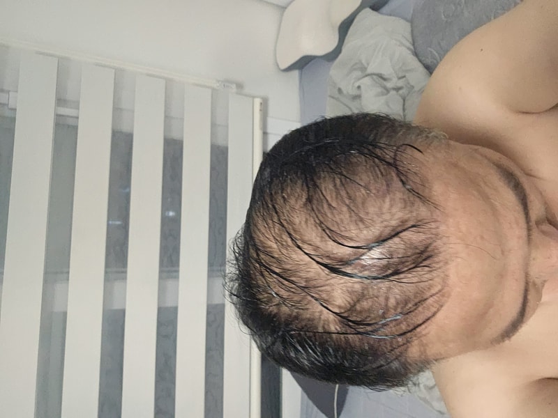 1000044722.jpg