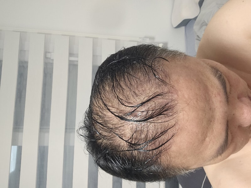 1000044721.jpg