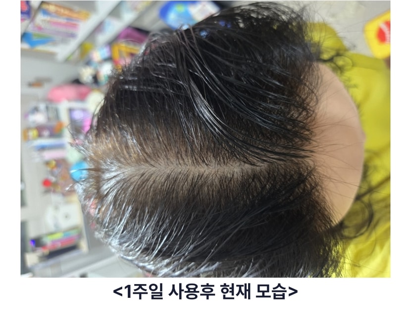 처음 그로우셀 사용 두피