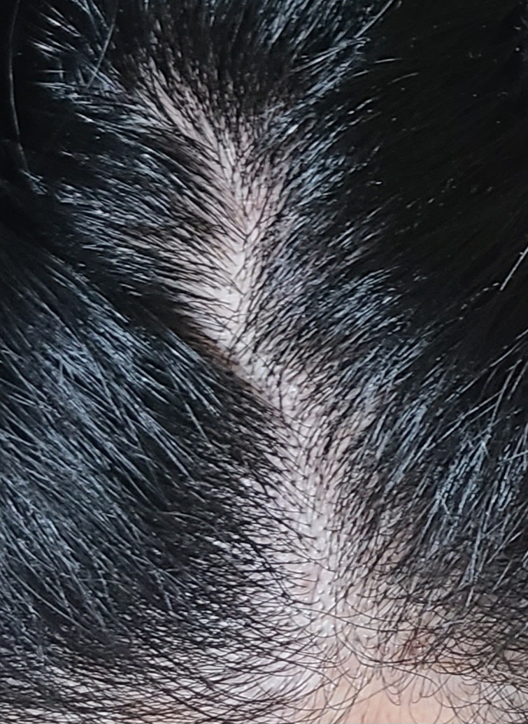 20251212_213815.jpg