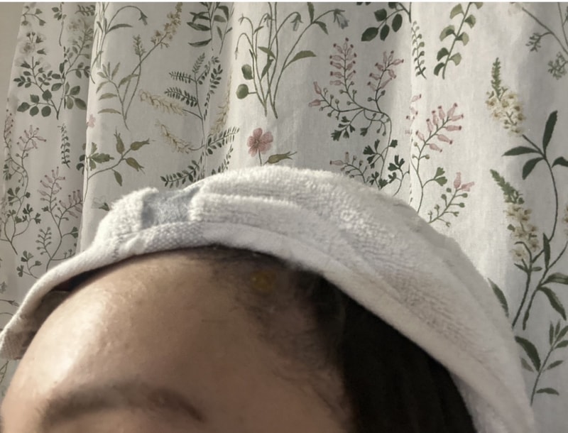 Late review of sweet pumpkin on the first day of Ryeo's use (including before and after photos).jpeg